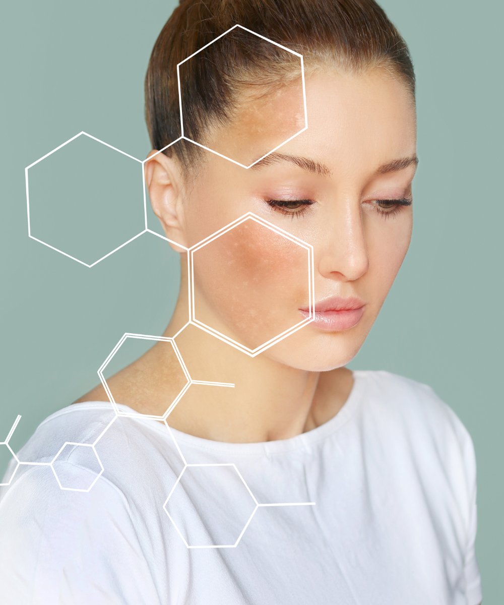 Vitamin C  Skin Brightening Series