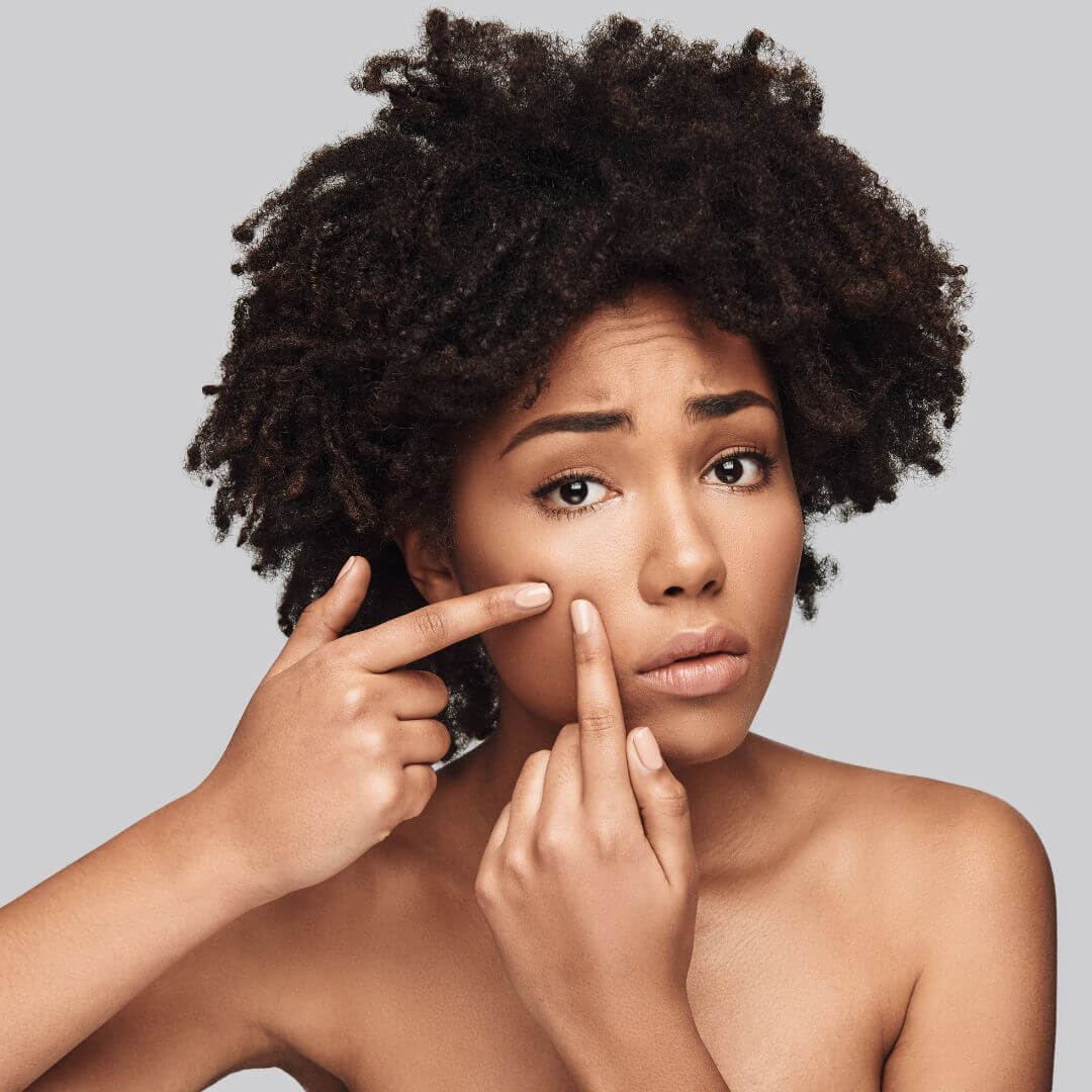 Acne Treatment Joy Pretty Skin
