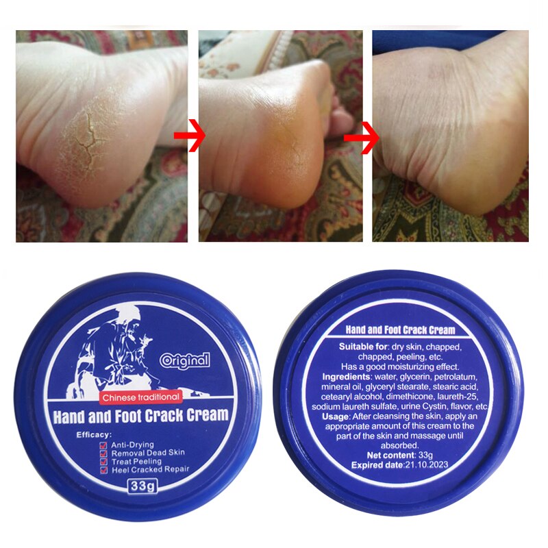 Ember Foot Cream For Rough, Dry and Cracked Heel, Feet Cream For Heel Repair  - Price in India, Buy Ember Foot Cream For Rough, Dry and Cracked Heel,  Feet Cream For Heel