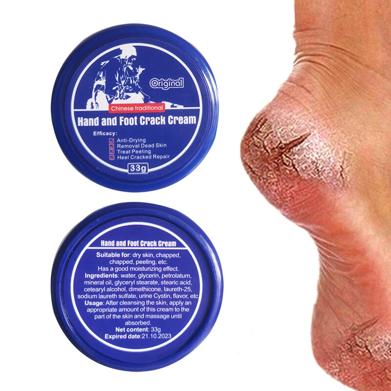 15ml Foot Cream Anti Fungal Infection Fungus Gel Repair Dry Crack Toe  treatment | eBay