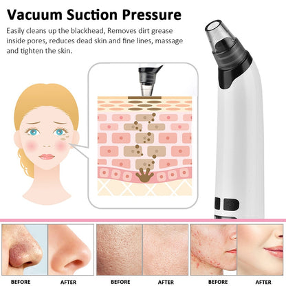 JoyPretty® Electric Blackhead Remover tool - Deep Pore Facial Cleaner for Black heads, Whiteheads, Acne Removal Joy Pretty Skin