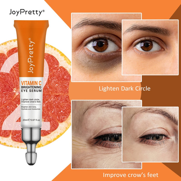 Vitamin C Under Eye Cream for Dark Circles and Eye Bags